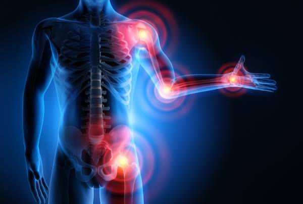 A csípőfájdalom lehetséges okai - Egészséges ízületek - Nyújtáskor fájdalom a csípőízületben