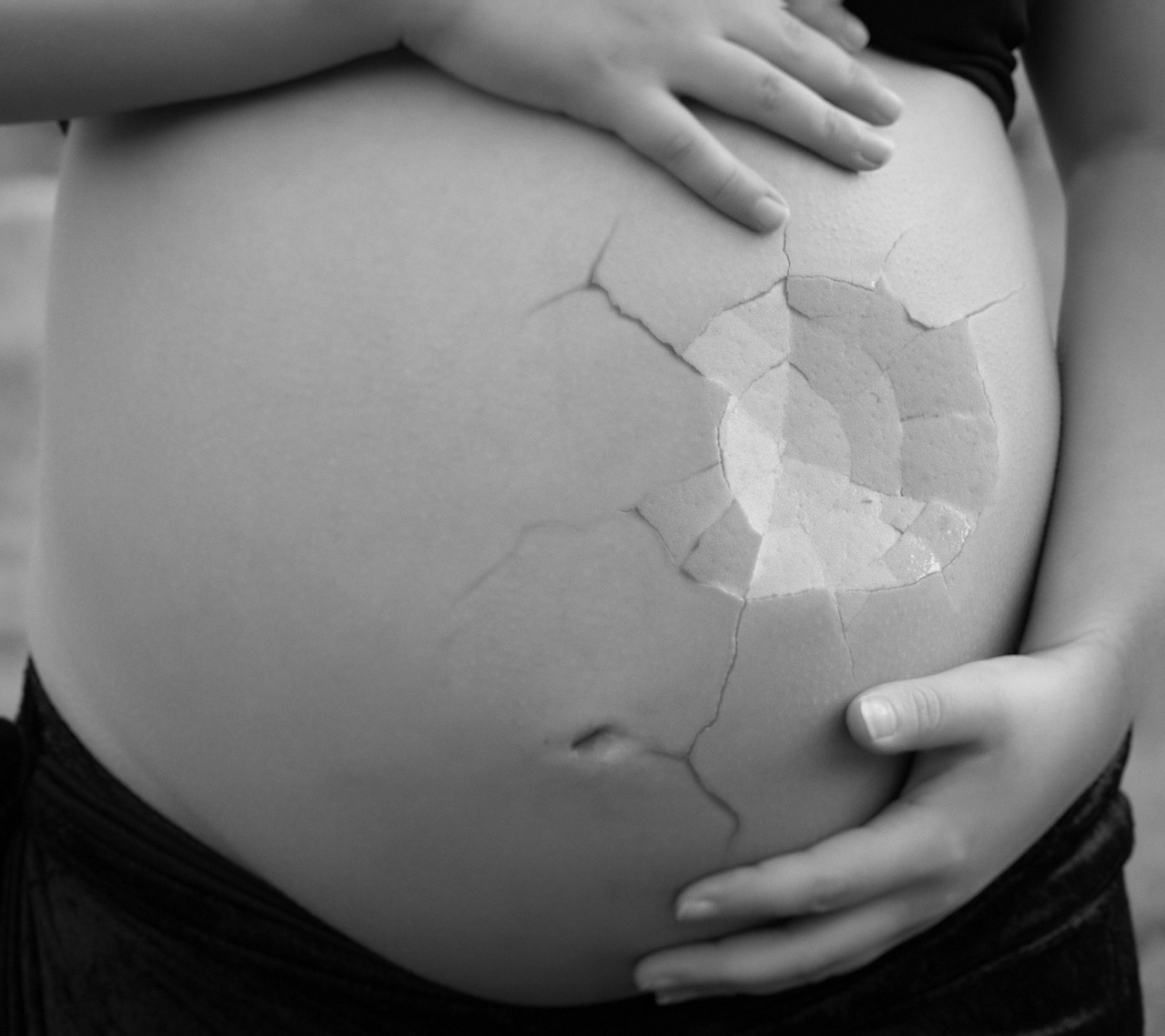 A terhességi diabétesz növelheti a fejlődési rendellenességek kialakulását