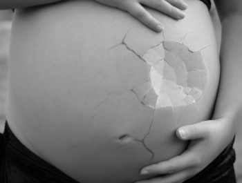 A terhességi cukorbetegség megelőzhető!